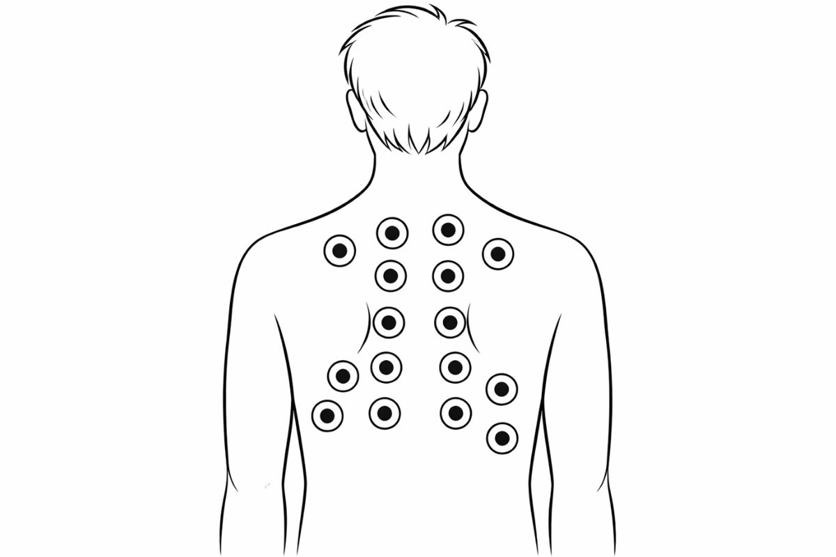 Mapa stawiania baniek - Gdzie stawiać bańki na plecach?